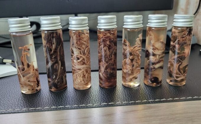 Myelid clots richard hirschman